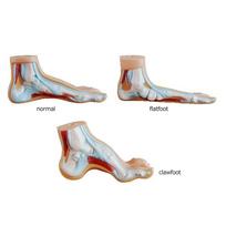 1 Pair Flat Feet Orthotic Plantar Fasciitis Arch Support Sleeve Cushion Pad Heel Spurs Foot Care Insoles foot Pad white