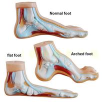Žmogaus pėdos modelis Pėdos raumenys Plokščiapėdystė Clubfoot (įgimta pėdos deformacija) Arkos pėdos modelis Anatomija Medicinos mokslas Mokymo modelis Nemokamas pristatymas