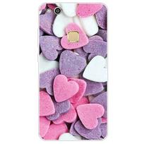 skirtas Huawei P10 lite dėklui silikoninis dėklas, skirtas huawei P10 minkštas TPU galinis dangtelis mielas animacinis katinas, gėlėtas telefono dėklas Coque Etui Huawei P10 pink