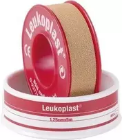 Söhngen Leukoplast Classic cinko oksido lipni pleistrų juosta 5 m x 1,25 cm balta 1009201
