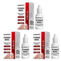 1-3x Fungi Nail Treatment Liquid Fast-Acting Nail Repair Strengthening Liquid Nails Care Supplies 1pcs