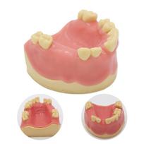 YOUYA 1 vnt. Dantų modelis Dantys Implantų praktikos modelis Dantis Dantų implantų modelis Mokomasis ekranas Odontologija Burnos mokymo modeliai beige