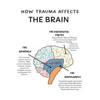Žmogaus nervų sistema Žmogaus smegenų anatomija Smegenų funkcija Plakato spaudinys Sienos menas Drobės tapyba Terapijos kabineto dekoravimui 60cm×100cm NoFrame