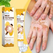 Bičių nuodų Vitiligo priežiūros kremas Bičių nuodų odos atstatymo ir drėkinimo kremas išoriniam naudojimui one size white