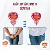 Magnetinė Vario Apyrankė Sveikatai - Juoda + Rožinė