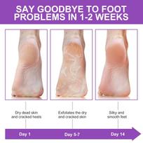 SANTALON Foot Peel Mask for Cracked Heels & Dry Feet – Exfoliating Foot Peeling Mask Socks with Natural Extracts Pair | Hydrating & Moisturizing F beige