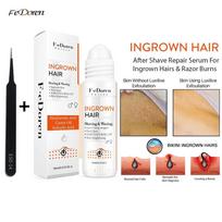 Razor Bumps Removal Solution Ingrowns Hair treatment Kit After Shave Repair Dark Spot Reduce Redness Serum for vanish PFB Pimple Razor Bump serum beige
