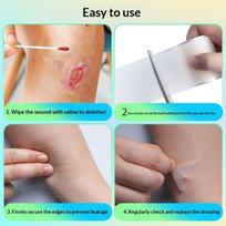 1Roll Hydrocolloid Acne Patch Roll Diy Cut-To-Size Pimple Cover Sticker, Ultra Thin Waterproof Blemish Tape For Face white