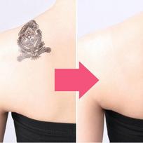 Pinocoro Premium Tattoo Scar Cover Sheet Tattoo Cover-Up 2023 New Model Natural 10 Sheets 1 pcs pink