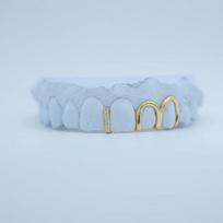 S925 Sterling Silver Open Face Grillz Teeth Set Gold Plated Hip Hop Hollow Upper & Lower Tooth Grillz Jewelry auksas