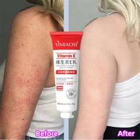 Reduce Chicken  Shrink Pores Fade Body Melanin Whiten Smooth Moisturize Skin Beauty Health beige