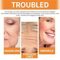 Collagen Wrinkle Remove Patches Firming Lifting Soluble Facial Patches Anti Aging Fade Fine Lines Moisturizing Face Care Masks one size white