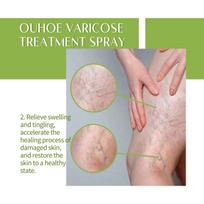 Care Spray: Repairs , Relieves Leg Swelling, Soreness, And Bulging Veins  Treatmentfor Legs one size beige