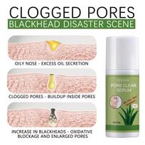 Blackhead Remover Deep Cleansing Acne Pore Dirts Oil Control Moisturizing Improving Rough Brightening Nose Treatment Cream one size beige