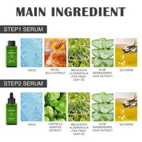 Blackhead Removal Kit with Tea Tree Oil  Deep Clean Refine Pores Moisturizing Set for Oily Skin Home Use one size beige