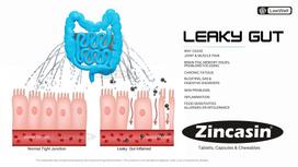 Zincasin Zinc Carnosine 75mg Supplement, 120 Tablets