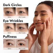 MIZON SNAIL INTENSIVE GOLD EYE GEL PATCH for Dark Circles, Moisturising Eye Serum Mask, Cooling Hydrogel for Under Eye Bags, Reduces Wrinkle 30 PAI beige