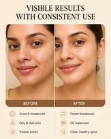 FOYU Skincare's Anti-Acne  CLEAR IT  Face Wash, with 2% Salicylic Acid and Niacinamide, Removes Pimples & Inflammation, Paraben and Sulphate Free, beige