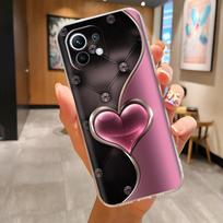 Skirta Xiaomi Mi 11 Lite 5G dėklas Telefono dėklas Apsauginiai galiniai dėklai Skirta Xiaomi Mi 11 Lite 5G NE Silikoninis dėklas Mi11 Lite Fundas For 11 Lite 5G NE black
