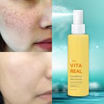 Glutathione Spot & Pigmentation Mist Serum white