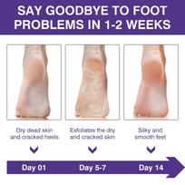 Korean Peeling & Exfoliating Foot Mask for Baby Soft Feet | Removes Dry Skin & Hard Calluses | Hydrates Dry Feet | Lavender Effect | Pack of 1 beige