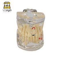 Dental Model For Children Deciduous Tooth Permanent Teeth Alternating Study Teathing Pediatric Dental Pathology Preventive Model