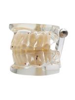 Dental Model For Children Deciduous Tooth Permanent Teeth Alternating Study Teathing Pediatric Dental Pathology Preventive Model beige