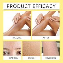 Bee Venom Care Soap - Gentle Skin Renewal Bar, Moisturizing Body Cleanser With Rich Lather For Smooth, Soft Skin one size beige