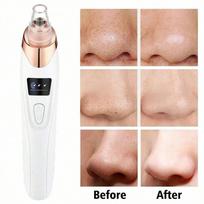Electric Pore Cleanser 5 Suction Power Blackhead Remover Vacuum Acne Removal For Deep Facial Pores Skin Care balta