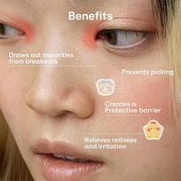 100Pcs Bear Face Skin Care Acne Pimple Patch Invisible Professional Healing brown