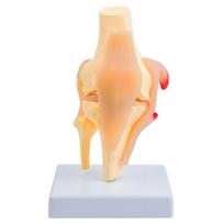 Anatomical Patella Knee Joint Model With Detailed Muscles Ligaments For Clinical Training and Classroom Demonstration 1 beige
