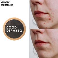 Geras dermatologinis prausimosi muilas nuo spuogų 115g (natūralus rankų darbo muilas giliai valo 99,9 % riebalų ir nešvarumų iš porų iki pat šaknų), 1 gabalėlis white