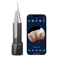 Yescamo Portable Ultrasonic Oral Cleaner Endoscope Self Teeth Cleanliness Care, Gray