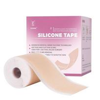 Silikono randų juostos lakštas – profesionalus vidutinio laipsnio pašalinimas, nedirginantis, nepavargęs C sekcijos, randų nudegimo keloidiniai spuogai, 4x150 cm pink
