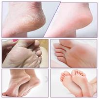 Exfoliating Foot Peeling Mask with 15% Glycolic Acid & 4% Lactic Acid, Aloe Vera Infused Foot Mask for Soft, Smooth Skin, Feet Peel Off Mask for C beige