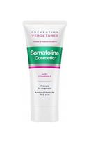 Kūno kremas Somatoline Strijų Prevencijos Kremas 200 ml Raminamoji Formulė