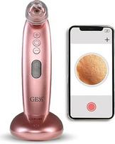 "GESS Sleek Blackhead Remover" ir porų vakuumas su fotoaparatu Veido valymo aparatas, skirtas aknei "Comedone Lifter Care" 4 keičiami priedai USB įkrovimo stotelė