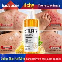 Dr. Rafiq Sulfur Anti-Acne and Anti-Mite Body Wash 100,000+ Success Stories white