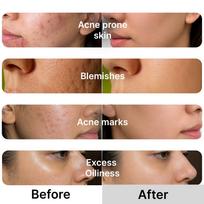 Essentive Niacinamide Capsule Cream 100g | 10% Niacinamide, TXA & Alpha Arbutin | Brightening Cream for Dark Spots, Pigmentation & Uneven Skin Tone white