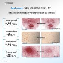 Fuerjia Acne Clearing & Purifying Wet Compress Mask beige