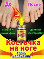 Ointment for hallux valgus deformity analgesic 55 g yellow