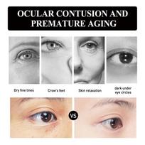 Strawberry Eye Gel Patches Reduce Fine Lines Dark Circles Puffiness Tighten Skin Anti Wrinkle Moisturizing 60 Pairs one size