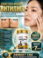 Anti vitiligo ointment china 50 g white