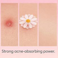 100Pcs Daisy Face Skin Care Acne Pimple Patch Invisible Professional Healing Onesize white