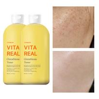 Spot blemishes freckles whitening whitening vitamin glutathione toner, 400ml, 2 pieces yellow