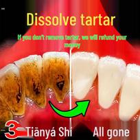LOSMVFCEE German Tartar Dissolving Mouthwash