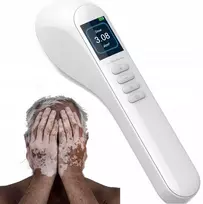 308nm Excimer Uvb šviesos terapijos prietaisas fototerapijai namuose nuo psoriazės