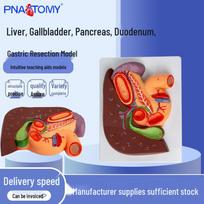 Liver, Gallbladder, Pancreas, Duodenum, and Stomach Cross-Section Anatomy Model 25x18x6.5 cm brown