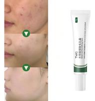 Salicylic Acid Pore Refining Cream 30g, Facial Skin Smoothing Cream, Refine Pores, Gentle Exfoliating Cream for Rough & Blemish-Prone Skin All skin type
