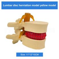 Profesionalus juosmens modelis Žmogaus anatomijos skeletas Stuburas Juosmens disko išvarža Mokymo modelis Demonstracinis modelis Mokymo modelis